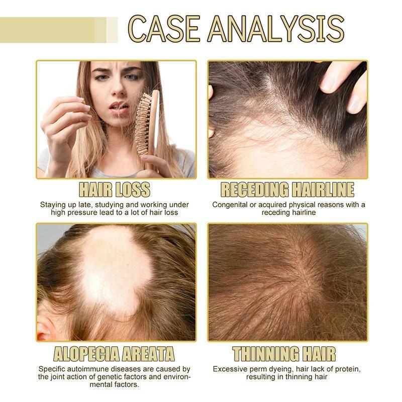 Veganic Natural Hair Growth Oil, Carvenchi Natural Hair Gro, Rosemary Oil for Hair Growth Organic, Rosemary Hair Growth Oil for Dry Hair and Growth Thin Hair Pump Serum Anti Aging(1PCS*60ML)