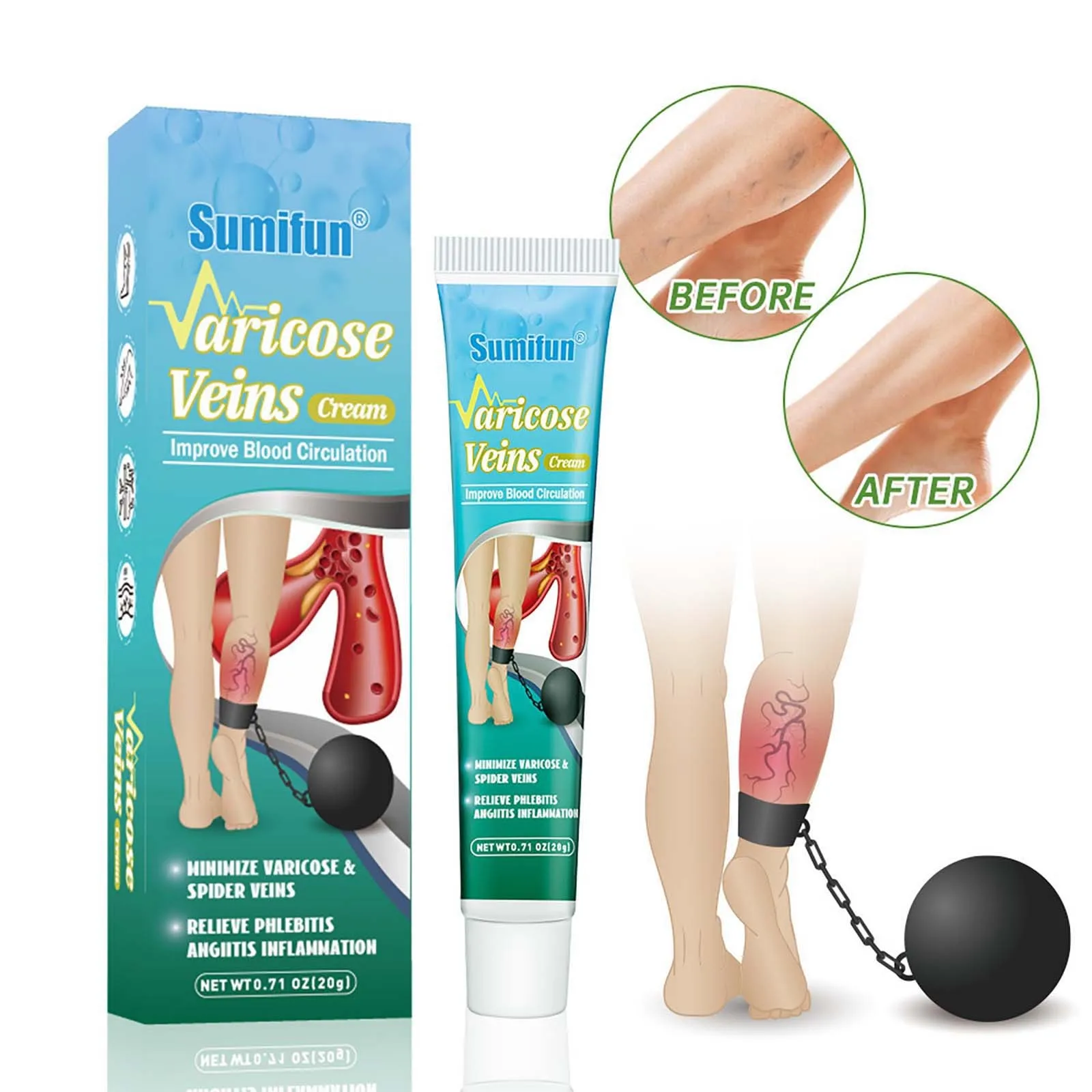 Varicose Vein Relief ,Improve Blood Circulations Spider Varicose Vein For Tired Heavy Legs Fast Relief Partijbenodigdheden