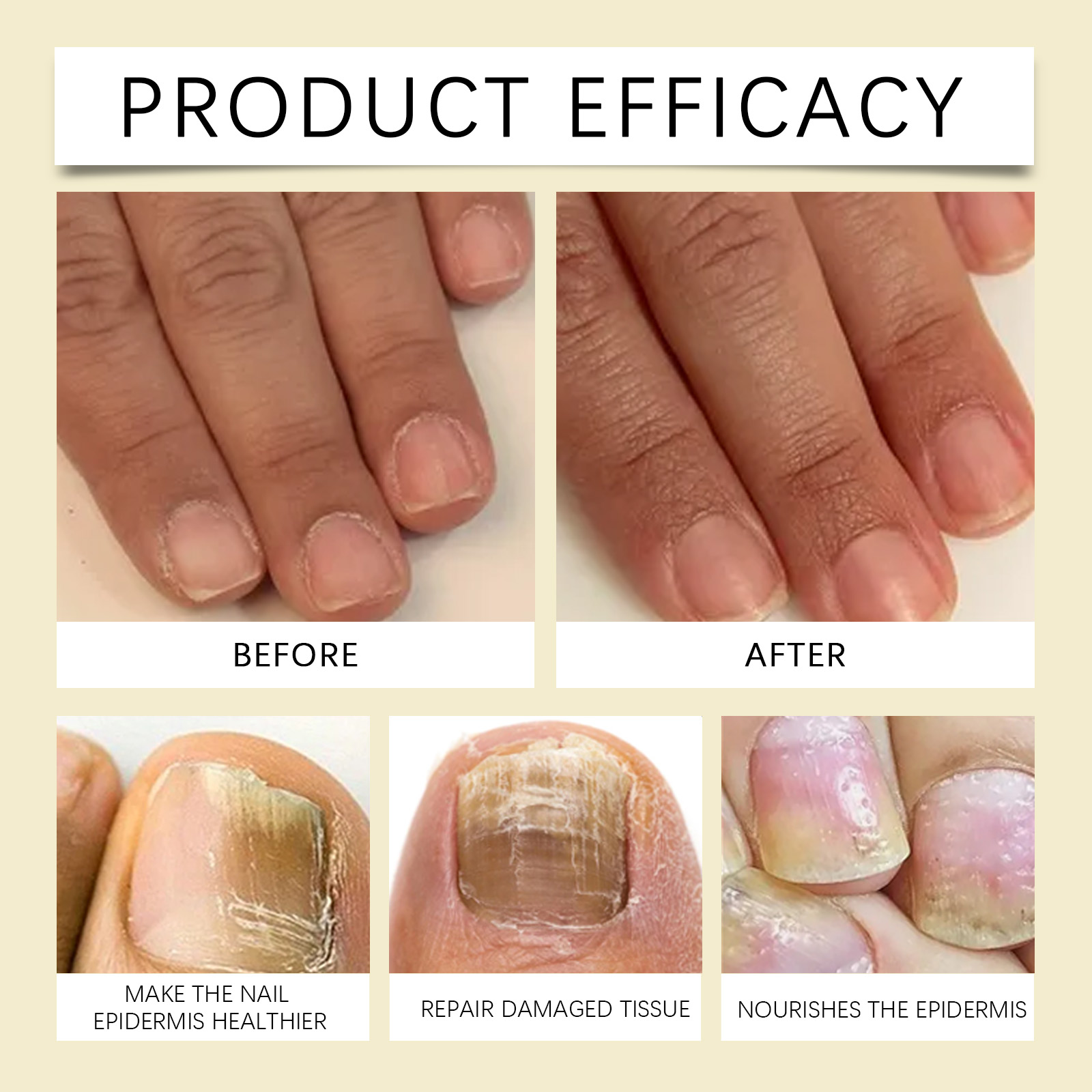 Eelhope Nail Care Solution Hand, Foot, And Nail Exfoliating Soft Nail Moisturizing